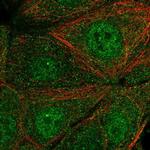 SYT17 Polyclonal Antibody