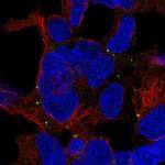 TRAPPC5 Polyclonal Antibody