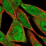 FXYD6 Polyclonal Antibody