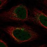 YIPF5 Polyclonal Antibody