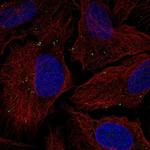 TMEM198 Polyclonal Antibody