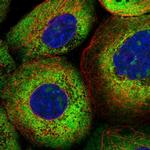 LAR4B Polyclonal Antibody