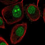 V-ATPase G1 Polyclonal Antibody