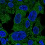 PSAT1 Polyclonal Antibody