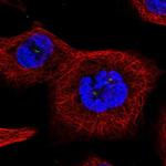 TTC39A Polyclonal Antibody