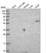 TTC39A Antibody in Western Blot (WB)