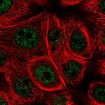 MSRB1 Polyclonal Antibody