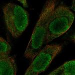 UACA Polyclonal Antibody