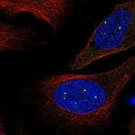 EVI5L Antibody in Immunocytochemistry (ICC/IF)