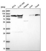 EVI5L Antibody in Western Blot (WB)