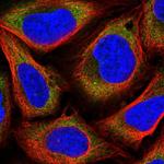 MAGED1 Polyclonal Antibody