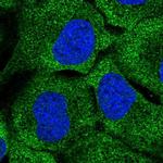 DNAH7 Polyclonal Antibody