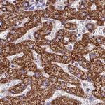 GLYAT Antibody in Immunohistochemistry (IHC)