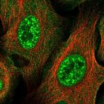 ZNF337 Antibody in Immunocytochemistry (ICC/IF)