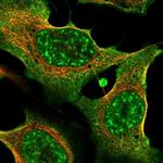 Thrombospondin 2 Polyclonal Antibody