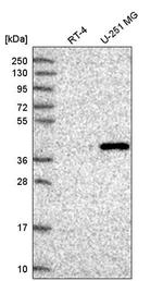 FAM8A1 Antibody in Western Blot (WB)
