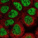 CDK8 Polyclonal Antibody