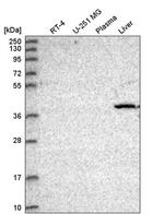 CDK8 Antibody in Western Blot (WB)