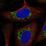 USMG5 Polyclonal Antibody