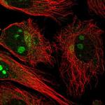 NCKAP5 Polyclonal Antibody