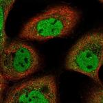 ARMC8 Antibody in Immunocytochemistry (ICC/IF)