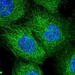 EXOC1 Polyclonal Antibody