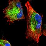 C11orf95 Polyclonal Antibody