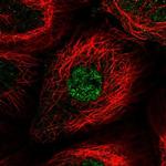 MCM8 Polyclonal Antibody