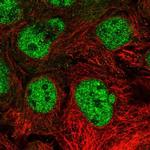 GCNF Polyclonal Antibody