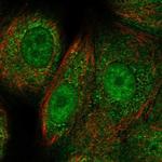 RAD51C Polyclonal Antibody