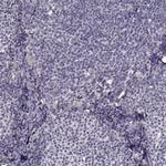 Growth Hormone Receptor Antibody in Immunohistochemistry (Paraffin) (IHC (P))