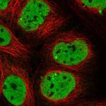 SCAF11 Polyclonal Antibody