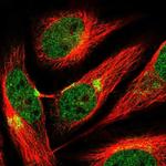 AP3B1 Polyclonal Antibody