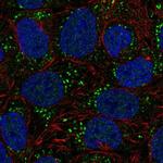 DGKA Polyclonal Antibody