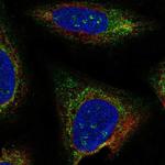 TMEM212 Antibody in Immunocytochemistry (ICC/IF)