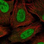 MED30 Polyclonal Antibody