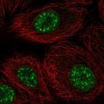 DAZAP2 Polyclonal Antibody