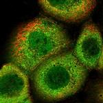 OAS2 Polyclonal Antibody