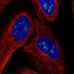 ZNF385B Polyclonal Antibody