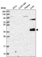 ZNF385B Antibody in Western Blot (WB)