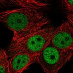 RNF168 Polyclonal Antibody