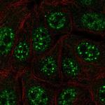 C12orf57 Polyclonal Antibody