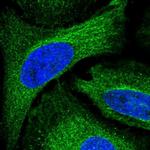 ADAL Polyclonal Antibody