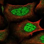 IKZF4 Polyclonal Antibody