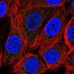 MCAR1 Polyclonal Antibody