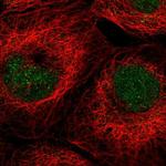 ALKBH3 Polyclonal Antibody