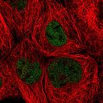 ZHX3 Polyclonal Antibody