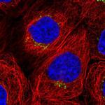 WDR44 Polyclonal Antibody