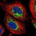 ACAD9 Polyclonal Antibody