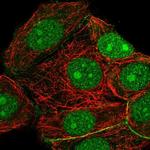 RRP7A Polyclonal Antibody